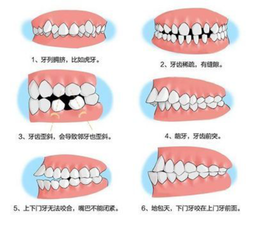 杭州种植牙多少钱一颗2021（杭州种一颗牙大概需要多少钱）(图1)